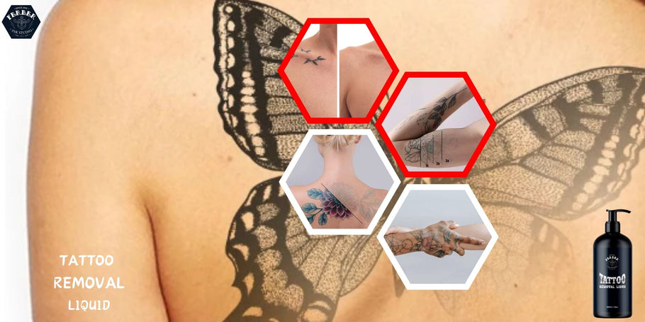 Where can you get the best tattoo removal liquid?